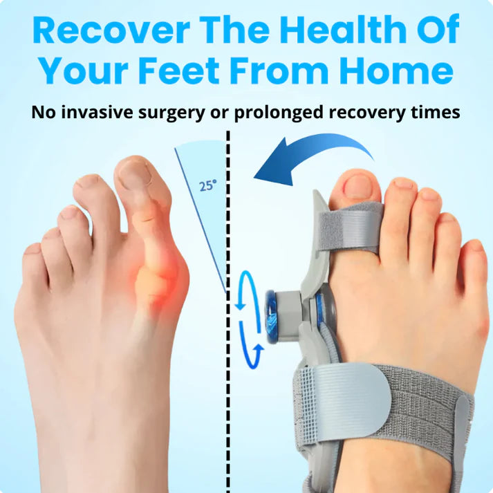 BuniFix™ - Non-Surgical Relief for Bunion Pain