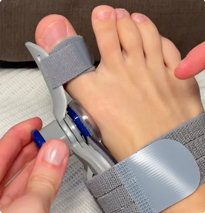 BuniFix™ - Non-Surgical Relief for Bunion Pain