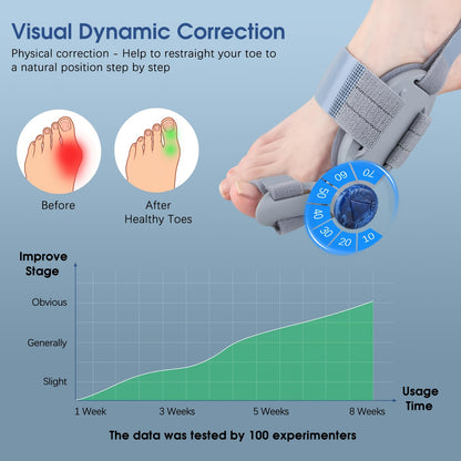 BuniFix - Elimina los juanetes en casa sin cirugía (Clínicamente comprobado)